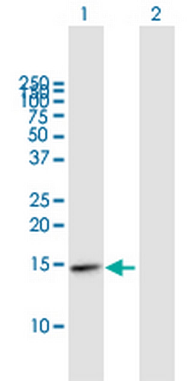 FABP5 Antibody in Western Blot (WB)