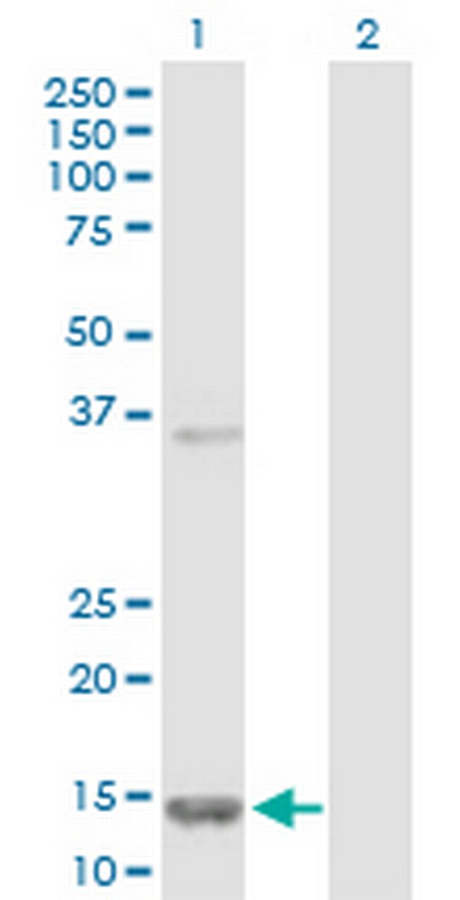 FABP5 Antibody in Western Blot (WB)