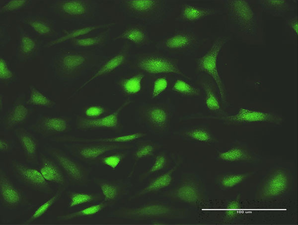 FANCC Antibody in Immunocytochemistry (ICC/IF)
