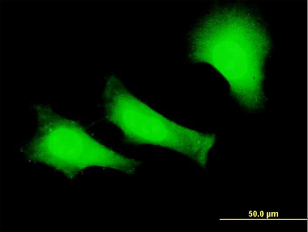 FANCC Antibody in Immunocytochemistry (ICC/IF)