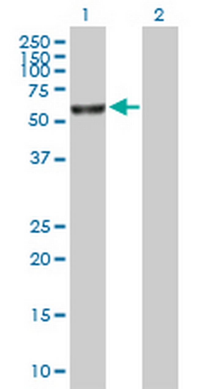 FANCE Antibody in Western Blot (WB)