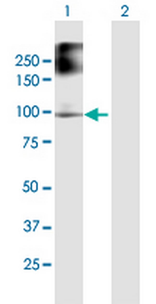 FANCB Antibody in Western Blot (WB)