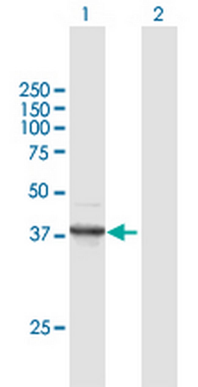 FANCF Antibody in Western Blot (WB)