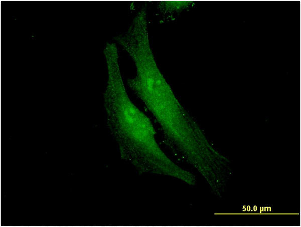 FANCF Antibody in Immunocytochemistry (ICC/IF)