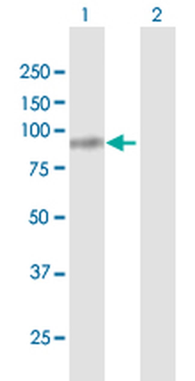 FBLN1 Antibody in Western Blot (WB)