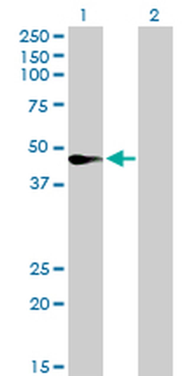 FASN Antibody in Western Blot (WB)