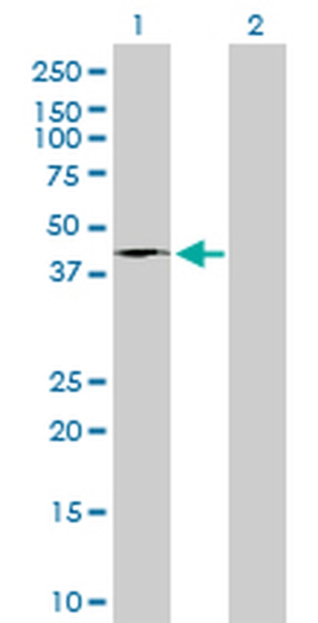 FASN Antibody in Western Blot (WB)
