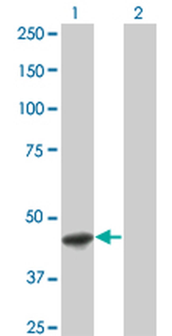 FASN Antibody in Western Blot (WB)