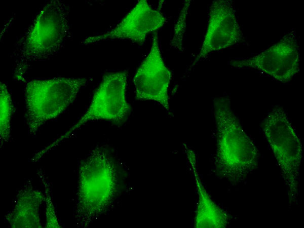 FAU Antibody in Immunocytochemistry (ICC/IF)