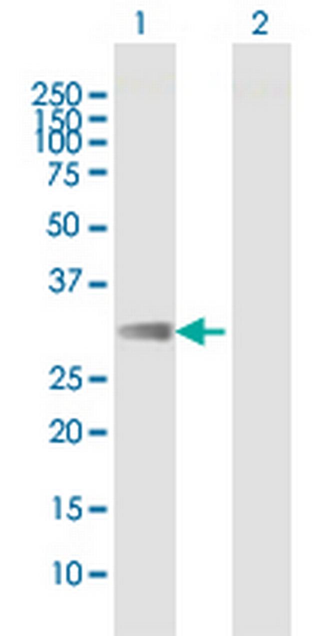 FCAR Antibody in Western Blot (WB)