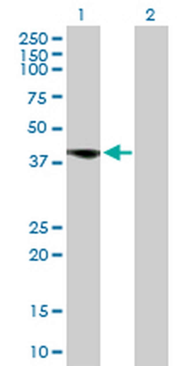 FCER2 Antibody in Western Blot (WB)