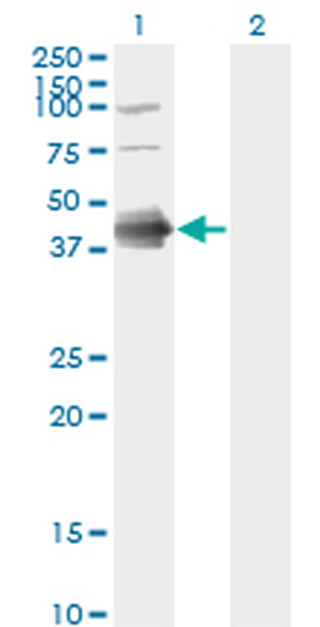 FCER2 Antibody in Western Blot (WB)