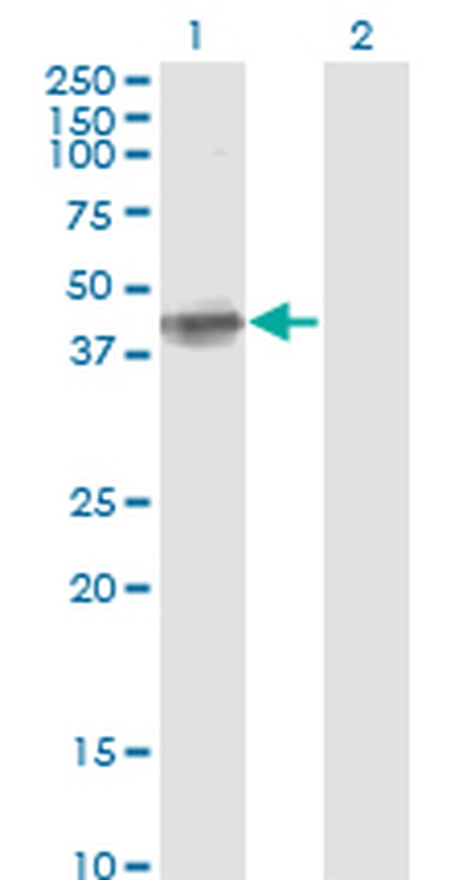 FCER2 Antibody in Western Blot (WB)