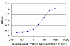 FCER2 Antibody in ELISA (ELISA)