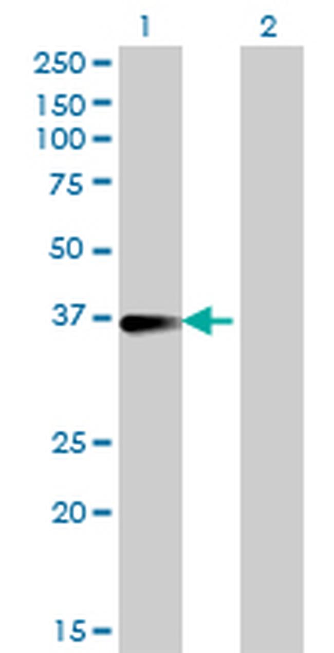 FCER2 Antibody in Western Blot (WB)
