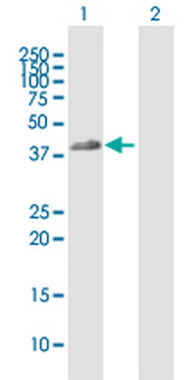 FCGR2A Antibody in Western Blot (WB)