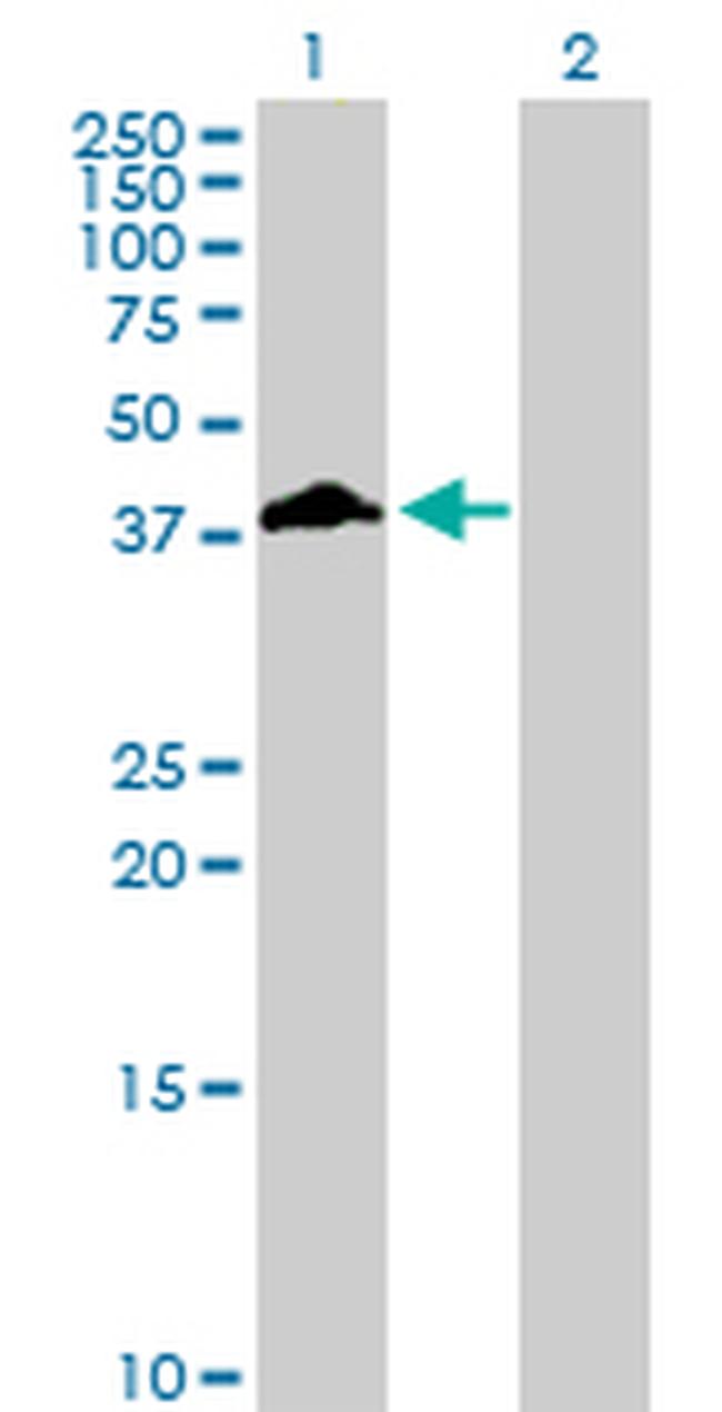 FCGR2B Antibody in Western Blot (WB)
