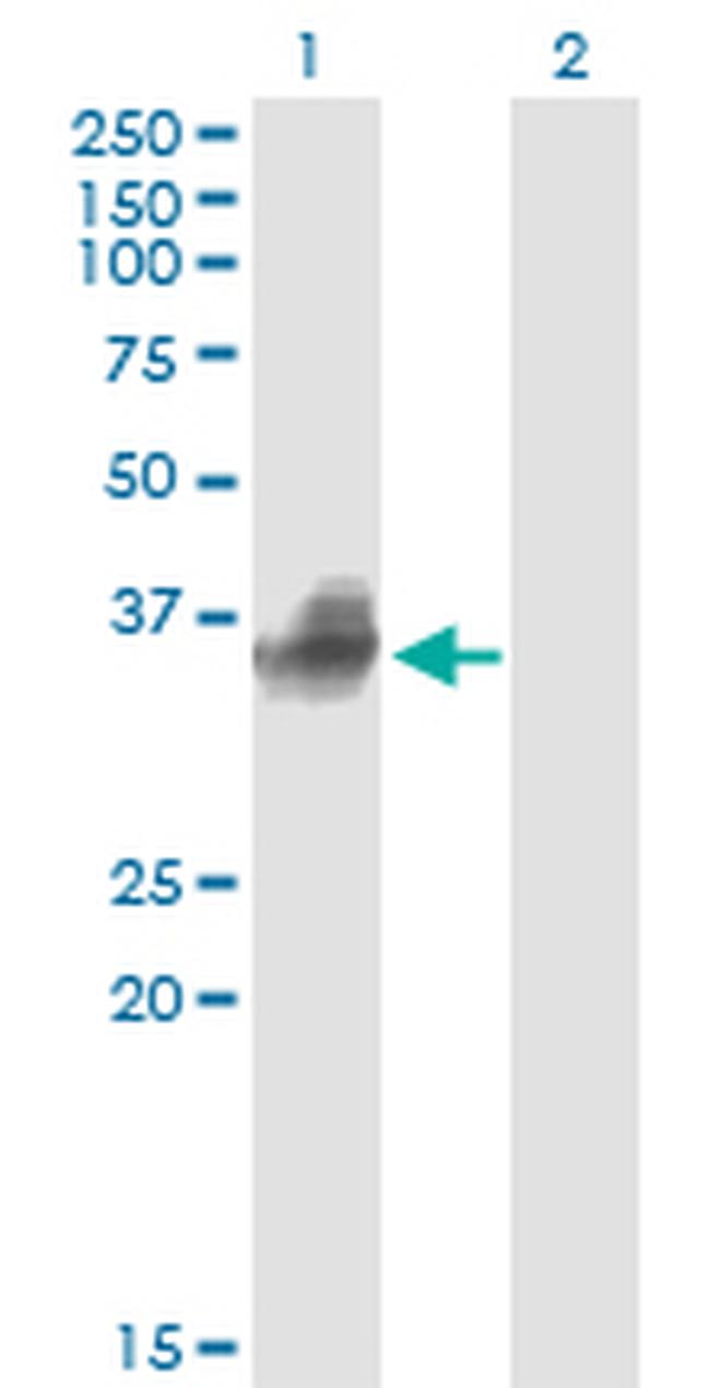 FCGR2B Antibody in Western Blot (WB)