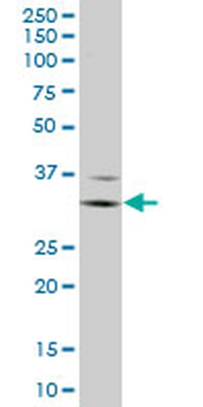 FCGR3A Antibody in Western Blot (WB)