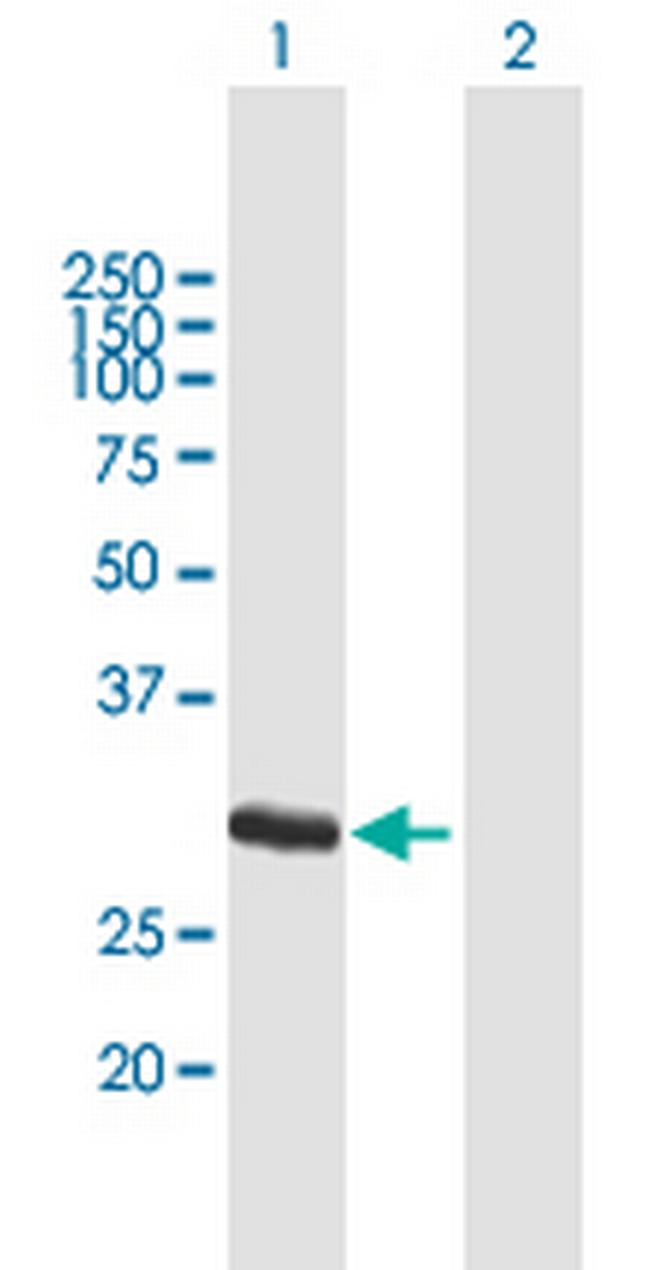 FCN1 Antibody in Western Blot (WB)