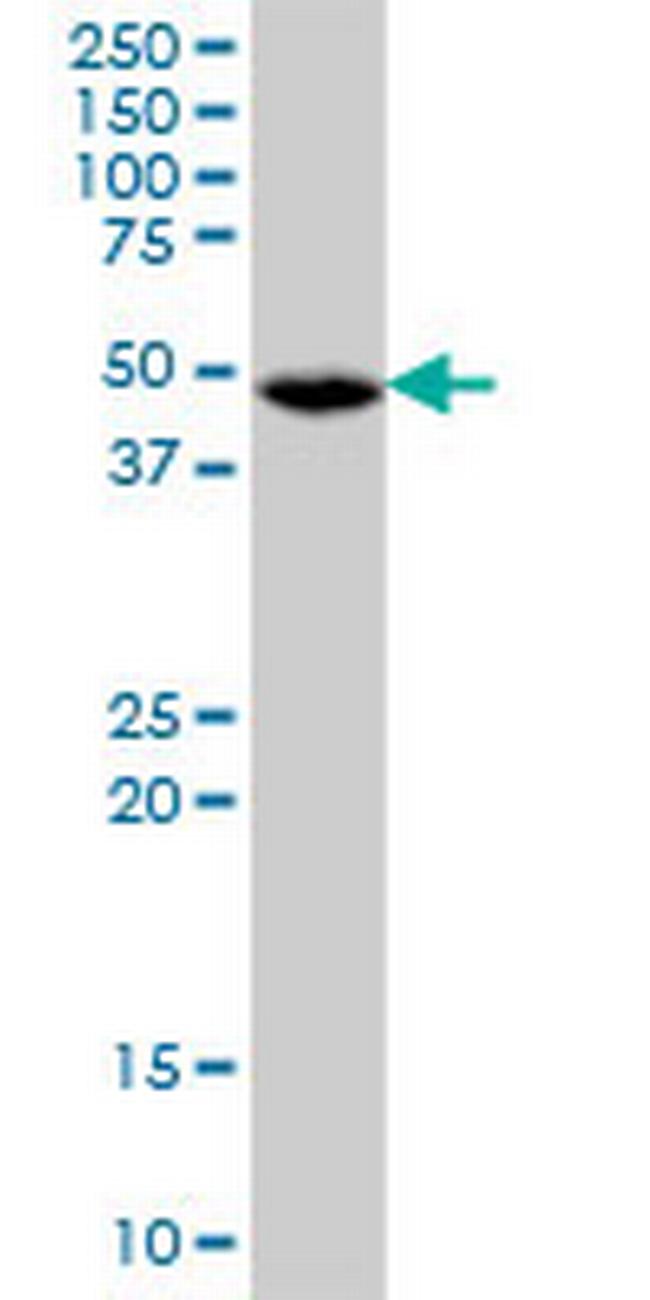FDXR Antibody in Western Blot (WB)