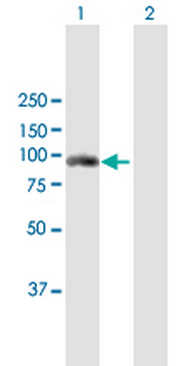 FES Antibody in Western Blot (WB)