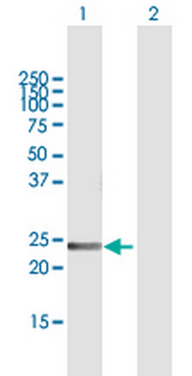 FGA Antibody in Western Blot (WB)