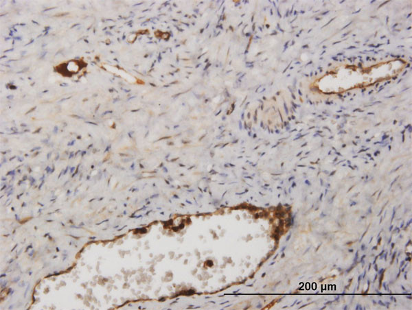 FGA Antibody in Immunohistochemistry (Paraffin) (IHC (P))