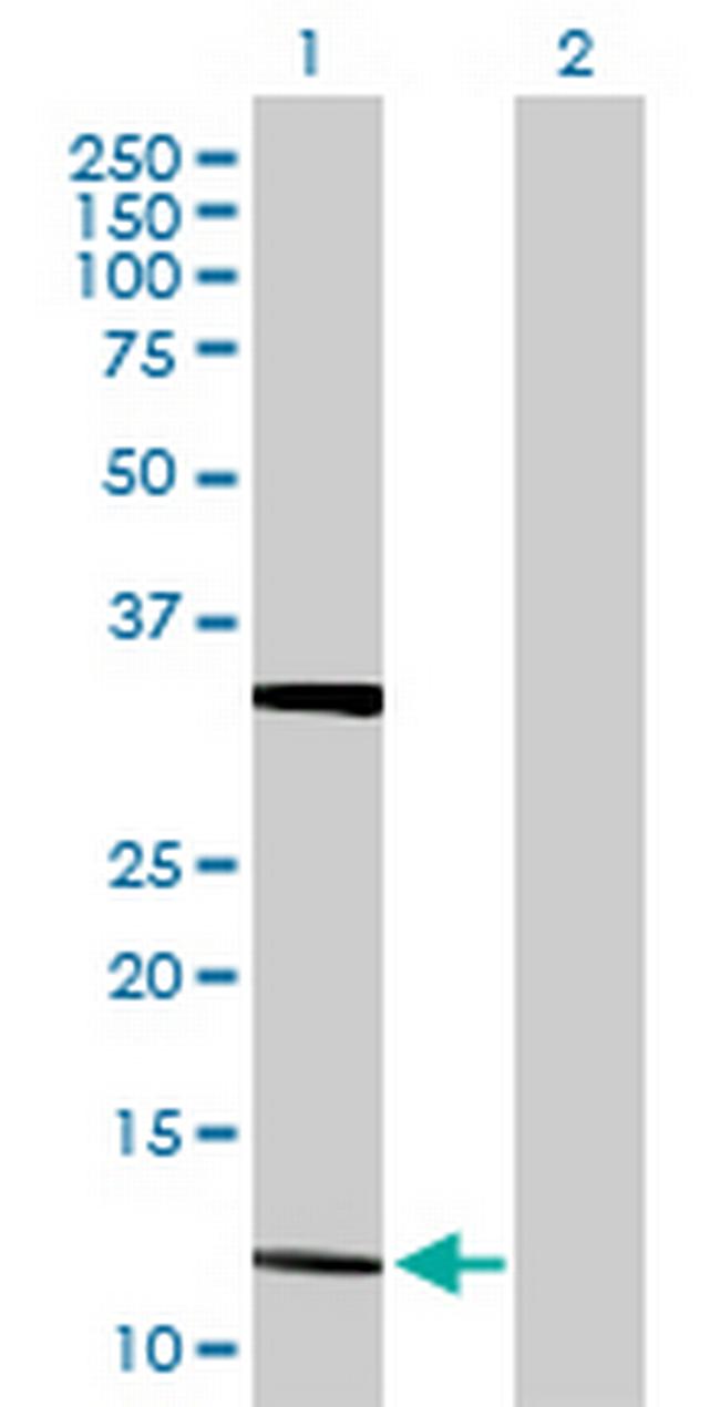 FGF5 Antibody in Western Blot (WB)