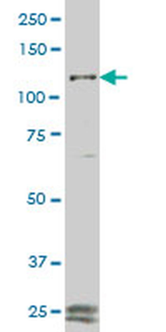 FGFR1 Antibody in Western Blot (WB)