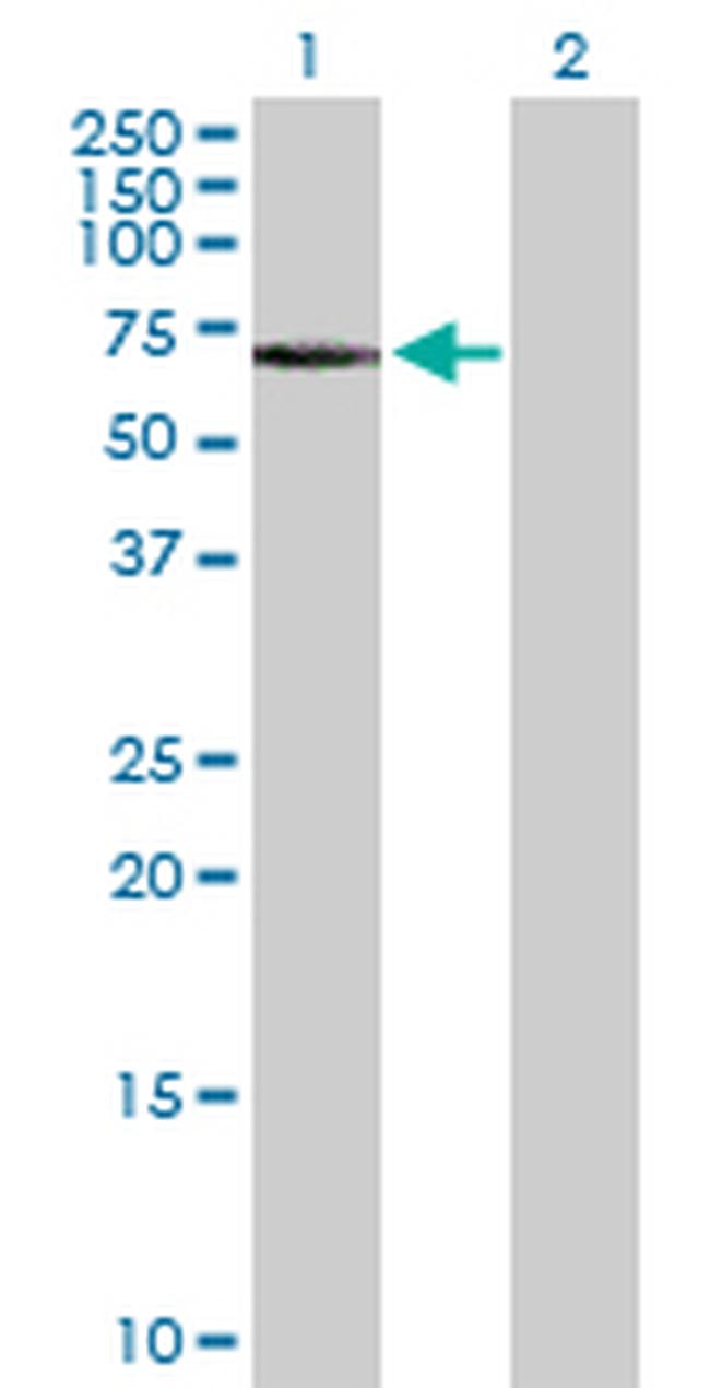 FGR Antibody in Western Blot (WB)