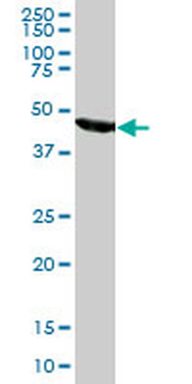FH Antibody in Western Blot (WB)