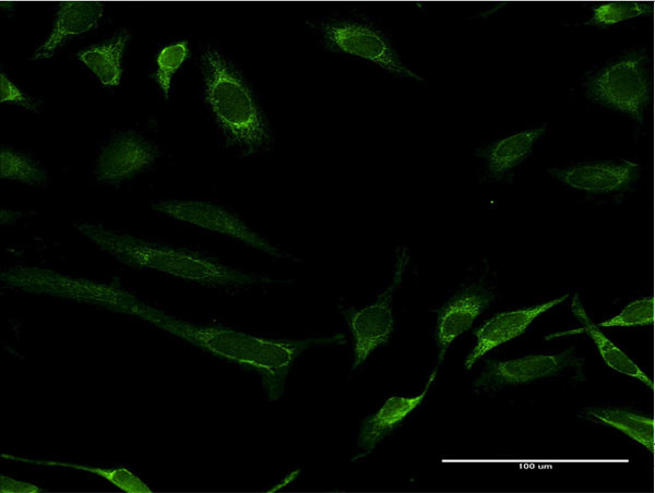 FH Antibody in Immunocytochemistry (ICC/IF)