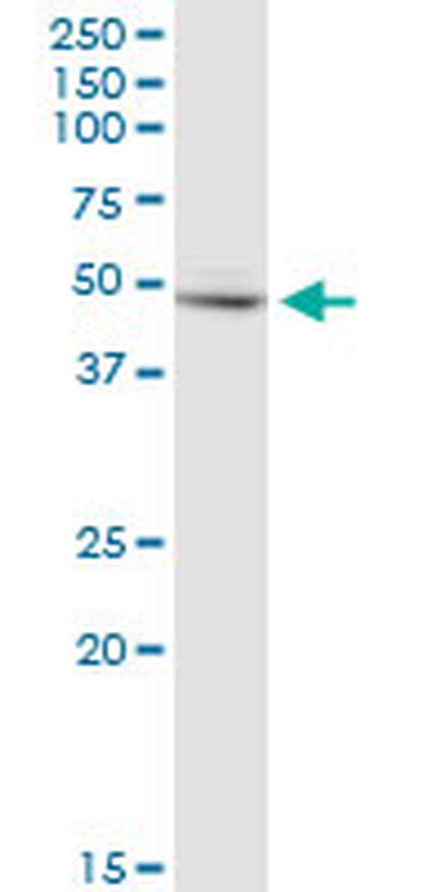 FH Antibody in Western Blot (WB)