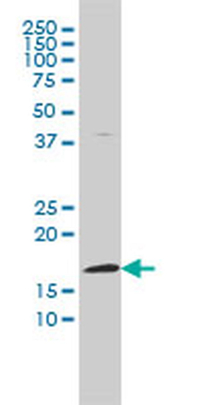 FHIT Antibody in Western Blot (WB)