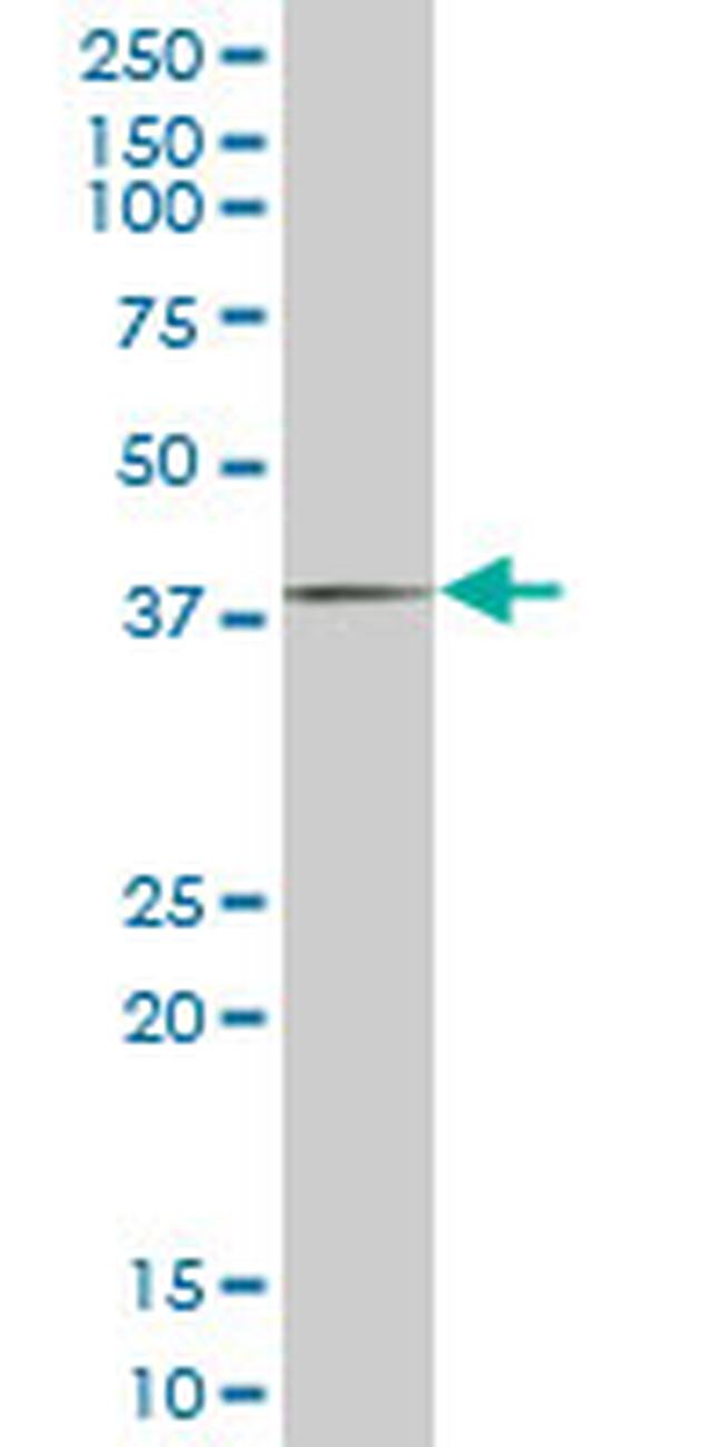 FHL1 Antibody in Western Blot (WB)