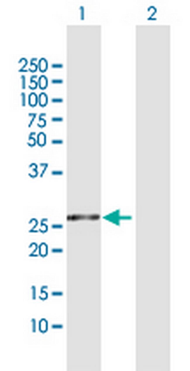 FKBP3 Antibody in Western Blot (WB)