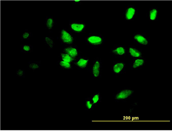 FOXF2 Antibody in Immunocytochemistry (ICC/IF)