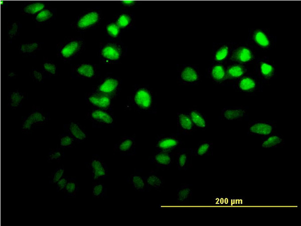 FOXF2 Antibody in Immunocytochemistry (ICC/IF)