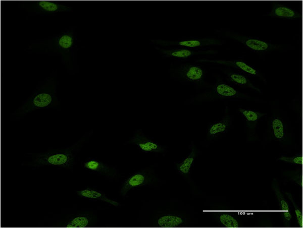 FOXL1 Antibody in Immunocytochemistry (ICC/IF)