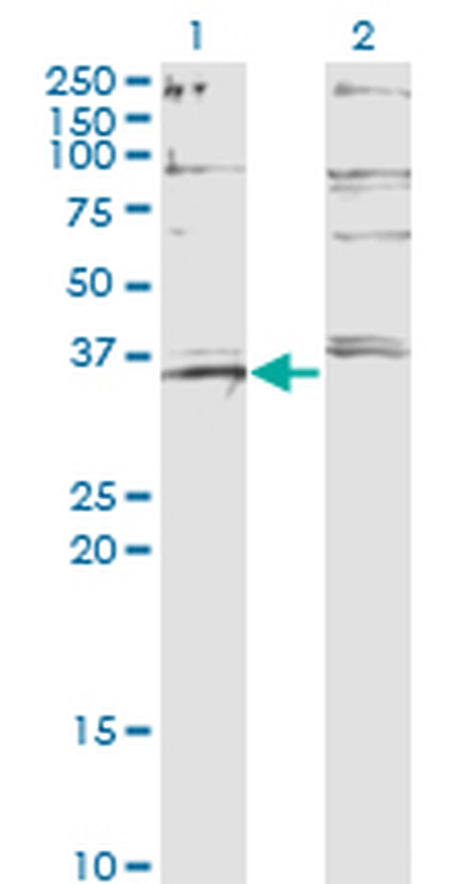 FOXL1 Antibody in Western Blot (WB)