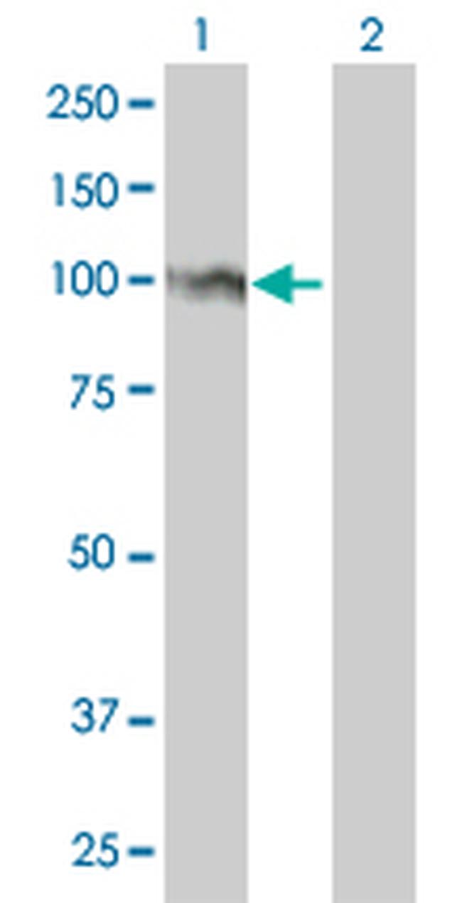 FOXM1 Antibody in Western Blot (WB)