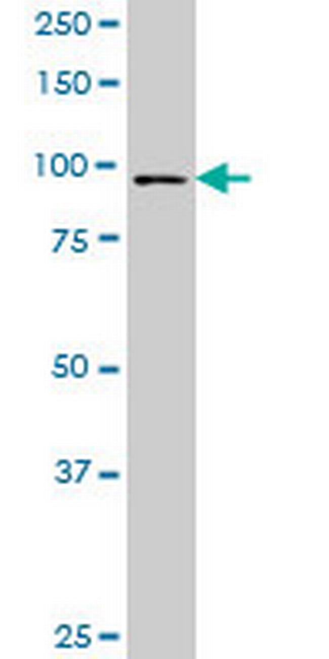FOXM1 Antibody in Western Blot (WB)