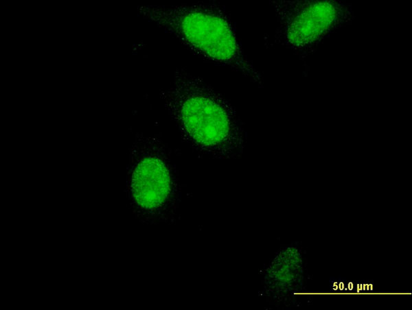 FOXM1 Antibody in Immunocytochemistry (ICC/IF)