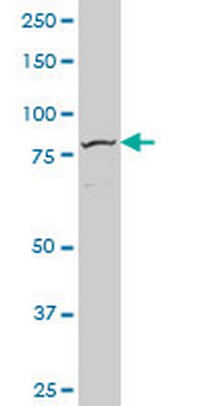 FOXM1 Antibody in Western Blot (WB)