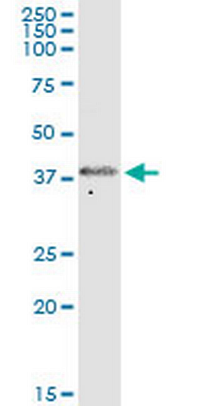 FKHL18 Antibody in Western Blot (WB)