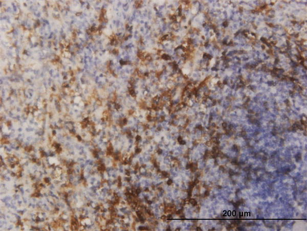 FOXO1A Antibody in Immunohistochemistry (Paraffin) (IHC (P))
