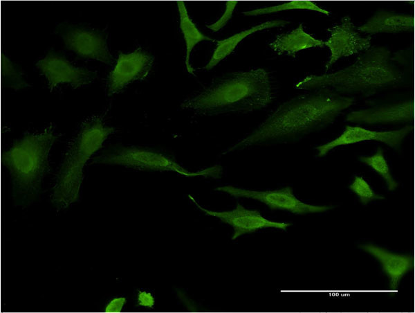 FOXO1A Antibody in Immunocytochemistry (ICC/IF)