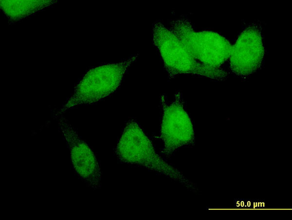 FOXO1A Antibody in Immunocytochemistry (ICC/IF)
