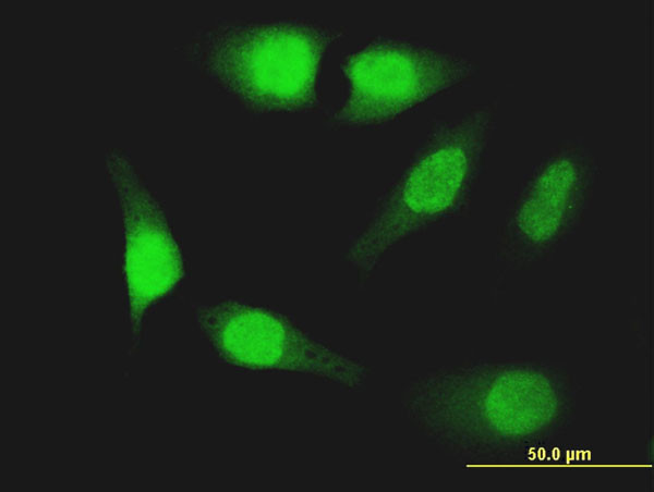 FOXO1A Antibody in Immunocytochemistry (ICC/IF)